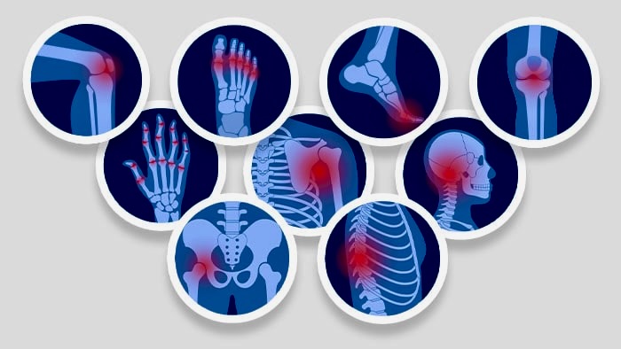 Understanding Chronic Pain: Causes, Management, and Long-Term Care